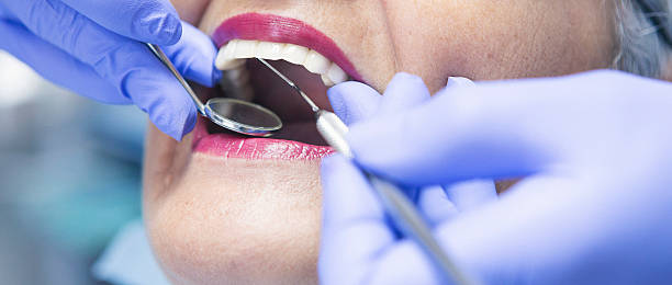 Best Emergency Gum Treatment in Addison, IL